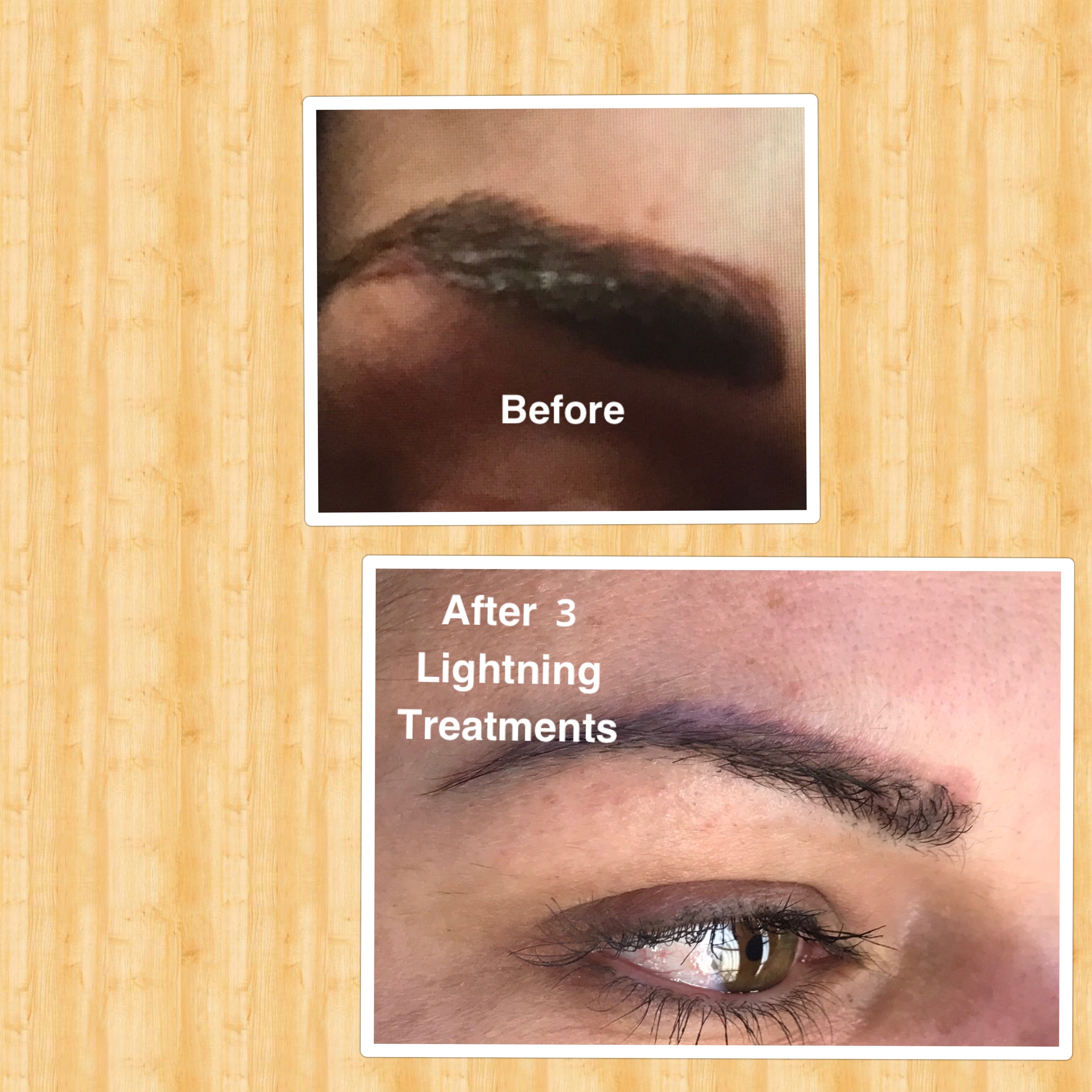 Lightning - Pigment Exfoliator - SofTap