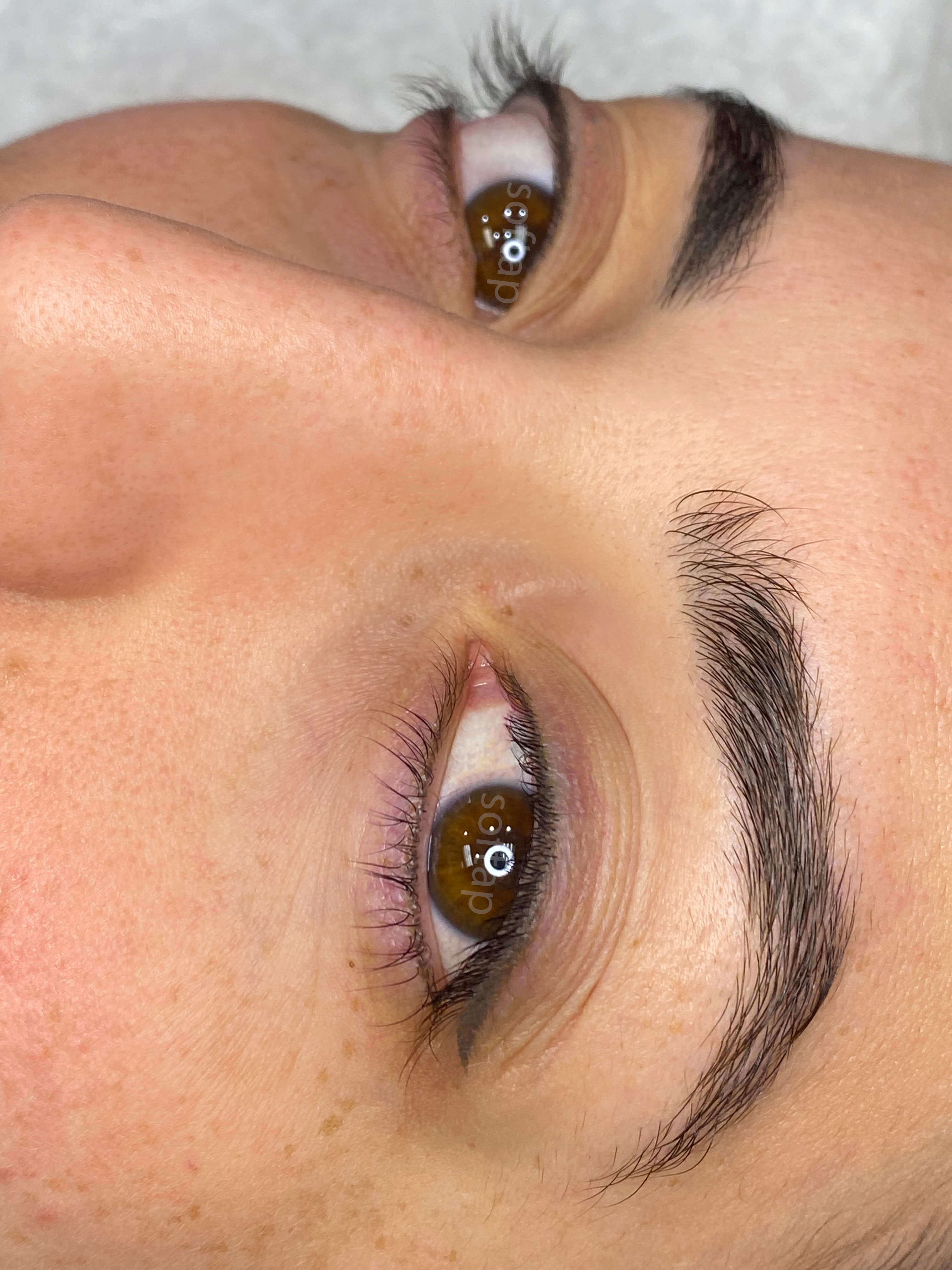 Close-up of a person's eye with Softap eyeliner healed naturally with brown irises and eyelashes.