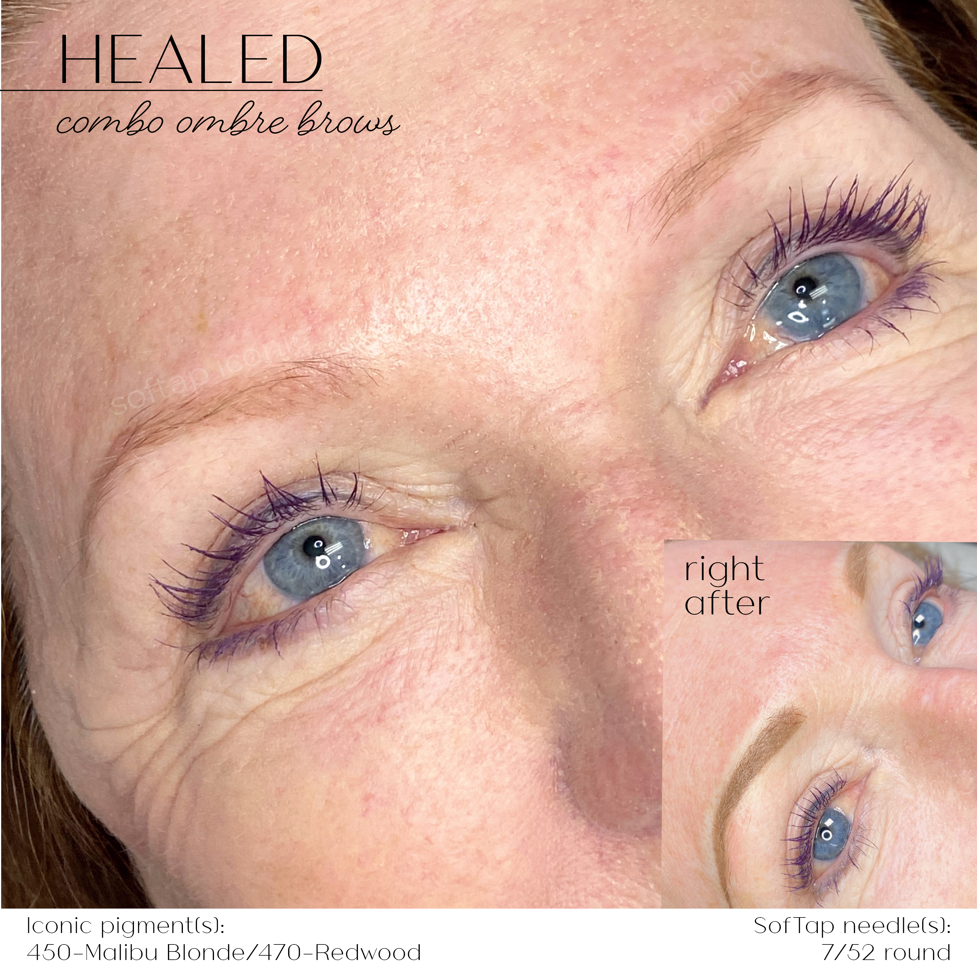 Iconic 450 - Malibu Blonde - SofTap