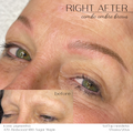Before and after comparison of SofTap combo ombre brows with text indicating product details.