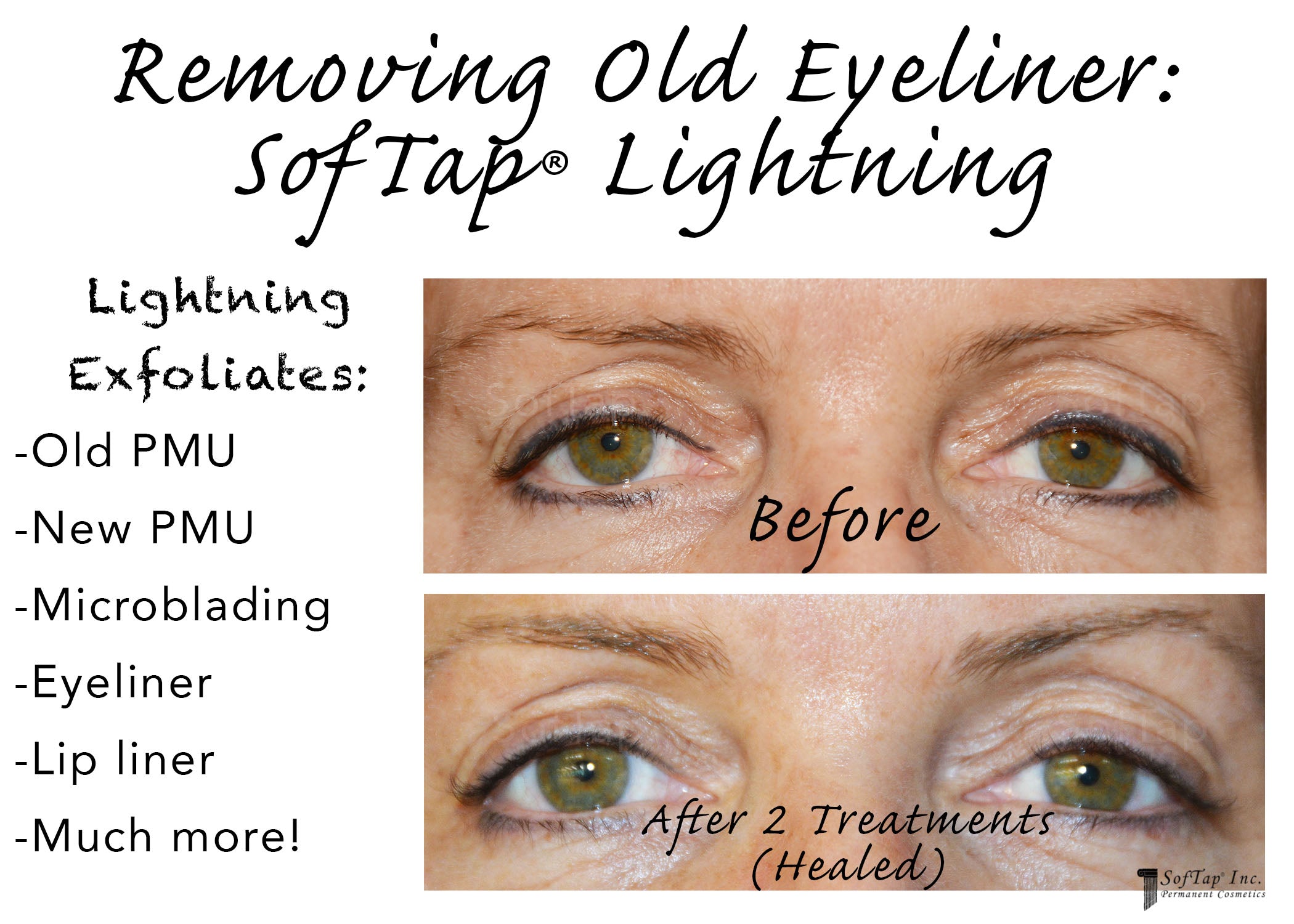 Lightning - Pigment Exfoliator - SofTap