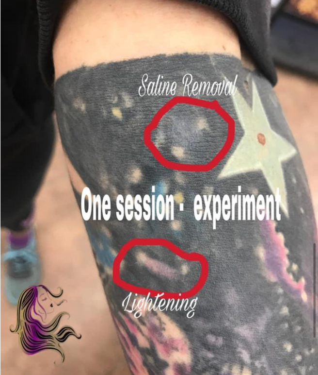 Lightning - Pigment Exfoliator - SofTap