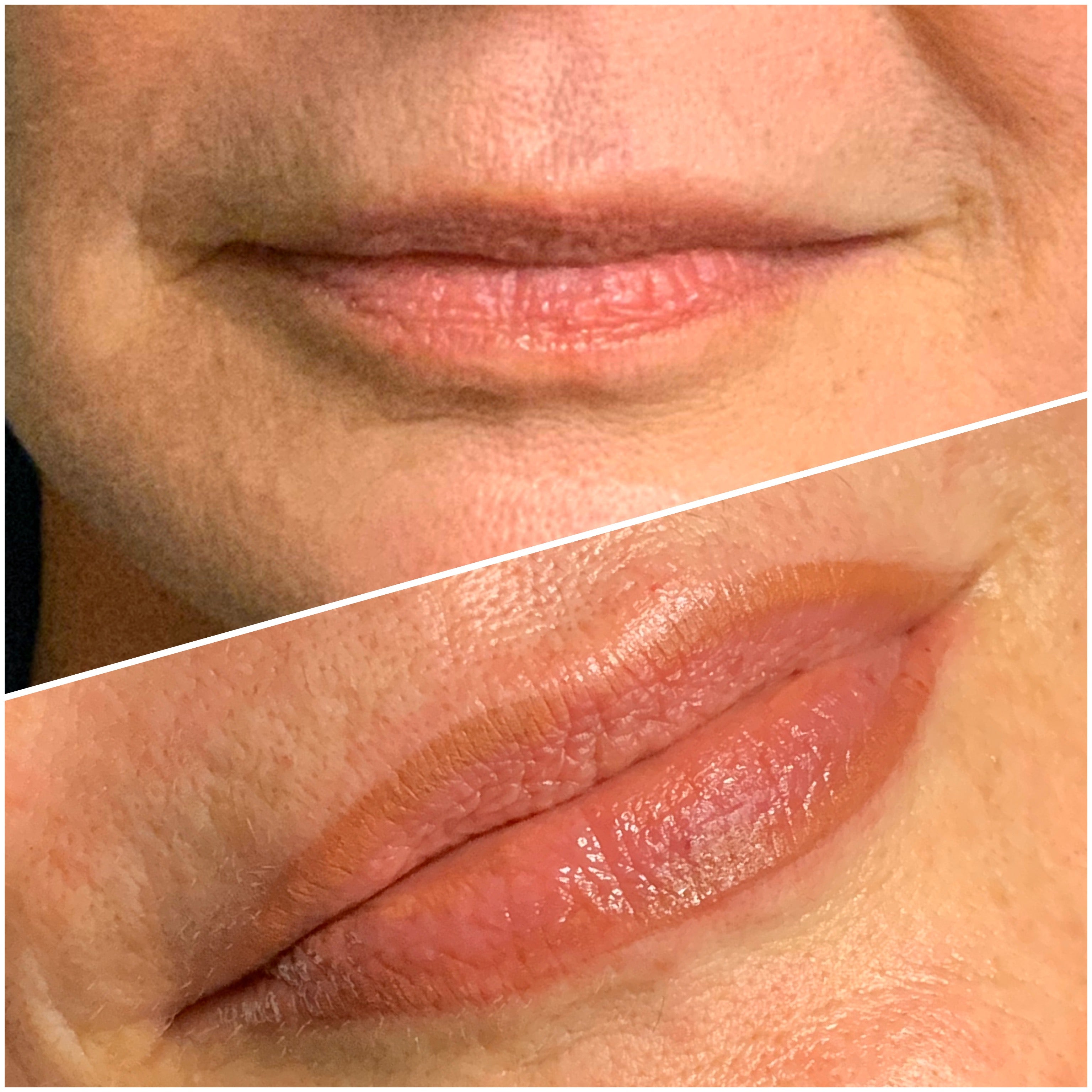 SofTap lip blush tattoo on medium skin, before and after